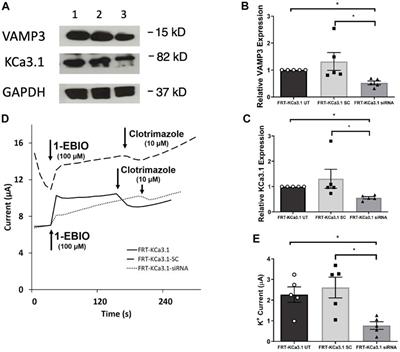 Role of SNARE Proteins in the Insertion of KCa3.1 in the Plasma Membrane of a Polarized Epithelium